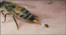 Breakthrough discovery: Honeybee venom could help treat triple-negative breast cancer Breakthrough discovery: Honeybee venom could help treat triple-negative breast cancer