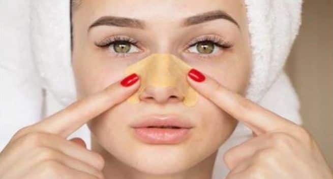 blackheads treatment