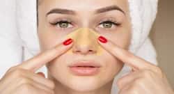 Blackheads causes and Ways to Prevent it