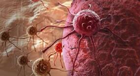 5 anti-cancer foods that you must definitely add to your diet