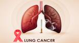 Lung Cancer