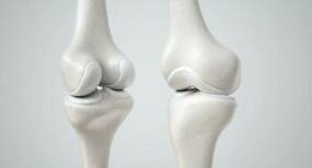These calcium rich foods will strengthen bones