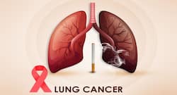 World Lung Cancer Day 2020: What are the latest treatment options for this condition?