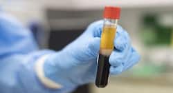 India likely to remove plasma therapy from its COVID-19 treatment guidelines : Here’s why