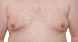 Man boobs can be an embarrassment: Avoid these foods and sport a manly chest