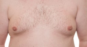 Man boobs can be an embarrassment: Avoid these foods and sport a manly chest