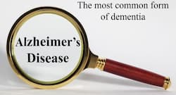 Symptoms of Alzheimer's Disease in Hindi: अल्जाइमर डिजीज के शुरुआती लक्षण और भूलने की इस बीमारी से बचने के लिए दो योगासन
