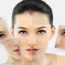 Dull skin: Reasons why your skin is looking lifeless and home remedies to treat it
