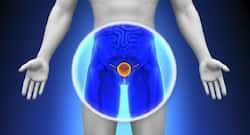 Enlarged prostate? 5 foods that you must avoid if you have this condition