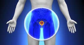 Enlarged prostate? 5 foods that you must avoid if you have this condition