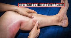 पैरों में दिखाई दें ये 2 संकेत तो जान लें नसों में बनने लगे हैं खून के थक्के, जानें किस बीमारी का शिकार होने वाले हैं आप