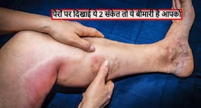 पैरों में दिखाई दें ये 2 संकेत तो जान लें नसों में बनने लगे हैं खून के थक्के, जानें किस बीमारी का शिकार होने वाले हैं आप