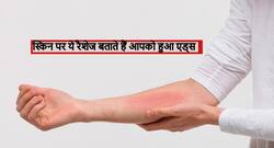 AIDS होने पर स्किन में तुंरत आ जाते हैं ये 4 बदलाव, समय रहते पहचानें इन्हें