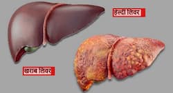 लिवर को हेल्दी रखने के लिए क्या करें? घर में बिना दवाओं के इन तरीकों से मजबूत करें अपना लिवर और रहें सेहतमंद