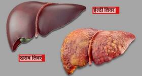 लिवर को हेल्दी रखने के लिए क्या करें? घर में बिना दवाओं के इन तरीकों से मजबूत करें अपना लिवर और रहें सेहतमंद