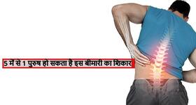 हर 5 में से 1 पुरुष 50 के बाद हो सकता है ऑस्टियोपोरोसिस का शिकार! जानें कौन सी चीजें कमजोर करती हैं हड्डियां