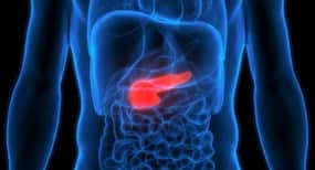 Are you obese? Go in for bariatric surgery to bring down your risk of pancreatic cancer