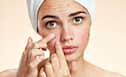 Tired of breakouts? Powerful home remedies you must try to get rid of acne