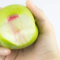 Home remedies for bleeding gums: Natural ways to keep your gums healthy