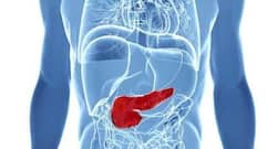 Pancreatic Cancer Can Creep Up Silently: Be Vigilant