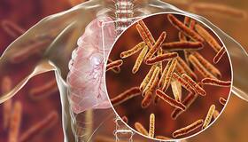 Tuberculosis vaccine could ‘lower the risk of contracting COVID-19’