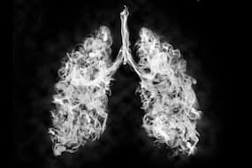 Vaping may increase 'respiratory disease risk by more than 40%'