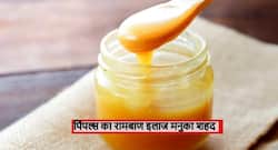 चेहरे पर दाने, पिंपल्स हो तो मनुका शहद का करें इस्तेमाल, मुलायम और नाजुक हो जाएंगे आपके गाल