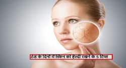 सर्दियों में फटी-फटी और रूखी स्किन से परेशान? फॉलो करें ठंड के दिनों में स्किन को हेल्दी रखने के 5 टिप्स और ट्रिक्स