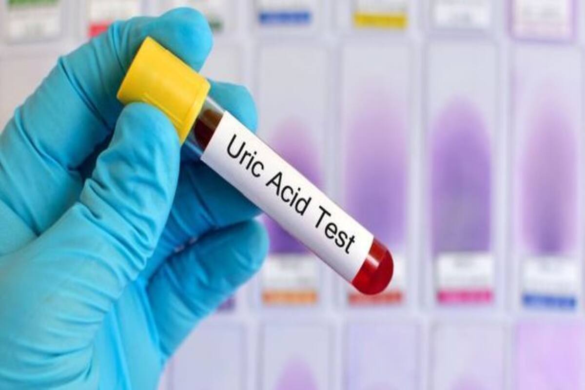 Extreme Uric Acid In Blood Is Dangerous A Few Tips To Maintain Ideal Levels