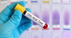 Extreme uric acid in blood is dangerous: A few tips to maintain ideal levels