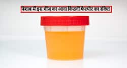 किडनी फेल्योर की शुरुआत है पेशाब में इस चीज का निकलना! जानें कारण, लक्षण और बचाव के टिप्स