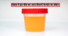 किडनी फेल्योर की शुरुआत है पेशाब में इस चीज का निकलना! जानें कारण, लक्षण और बचाव के टिप्स