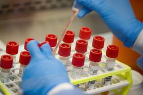 Moscow starts mass Covid-19 vaccination for at-risk groups with its Sputnik V shot