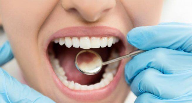 Bad dental health: Life-threatening illnesses caused by tooth decay