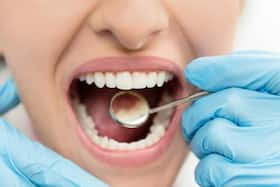 The Major Cause For Periodontitis That Leads To Tooth Loss Identified The Major Cause For Periodontitis That Leads To Tooth Loss Identified