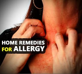 Are allergies bothering you? Home remedies to treat an allergic reaction