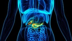 Having constant back pain? Beware, it could be the first sign of pancreatic cancer