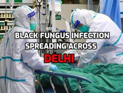 Black fungus infection linked with Covid-19 spreading across Delhi
