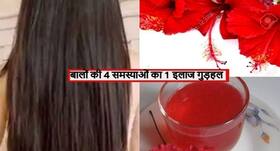 डैंड्रफ, रूसी और बालों के रूखेपन को दूर करती है गुड़हल की चाय, पोषण के साथ शरीर होता है डिटॉक्स