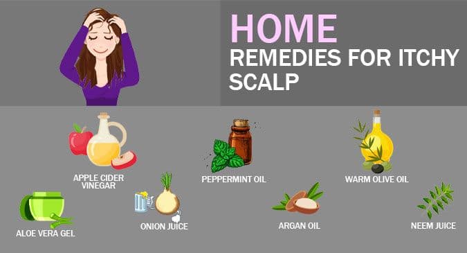 And dandruff natural itchy scalp home remedies for 