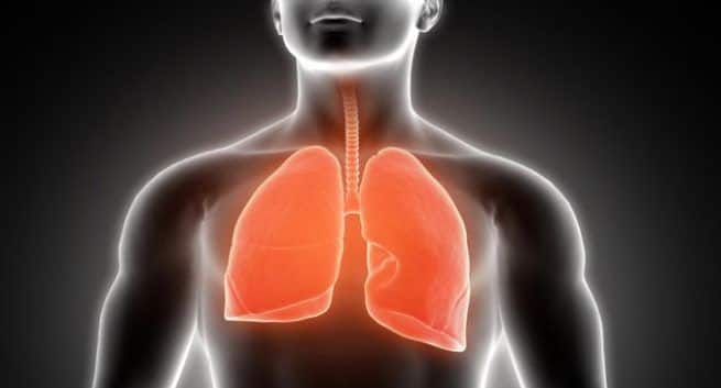 lungs cancer