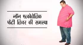 ऐसे पता करें आपको नॉन एल्कोहोलिक फैटी लिवर की समस्या है या नहींं, जानिए लक्षण और उपचार