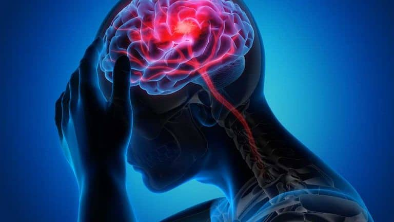 Beware! Brain pressure disorder that causes vision problems on the rise