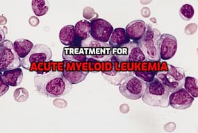 Acute myeloid leukemia: New drug combination can effectively treat this condition