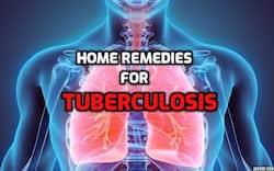 Tuberculosis: Here are some home remedies to accelerate the healing process