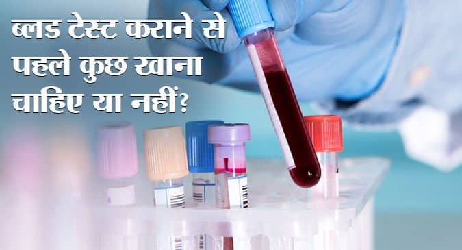 Blood Test Guideline: जानिए ब्लड टेस्ट कराने से पहले कुछ खाना चाहिए या नहीं | TheHealthSite.com हिंदी