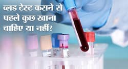Blood Test Guideline: जानिए ब्लड टेस्ट कराने से पहले कुछ खाना चाहिए या नहीं