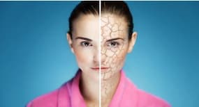 These 7 things are a big NO if you have dry skin