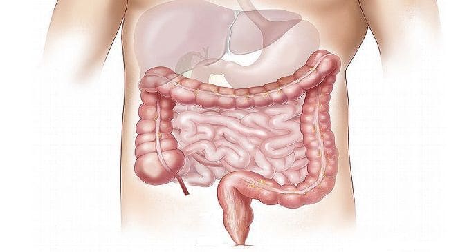 Docs perform a challenging procedure for rectum cancer and gall stones with robotic precision