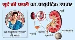 किडनी स्टोन या गुर्दे की पथरी का आयुर्वेदिक उपचार